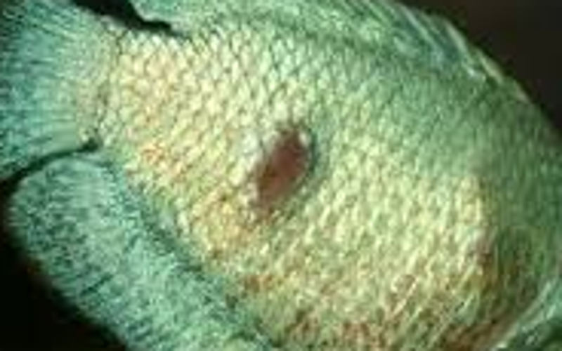 Fischtuberkulose beim Menschen